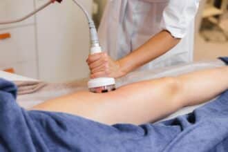 Ultrashape Medicina Estética en Puebla